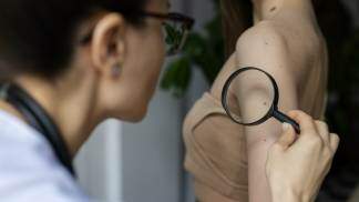 Médica analisando mancha na pele de uma mulher