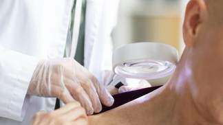 Médico examinando paciente com câncer de pele