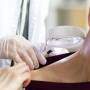 Médico examinando paciente com câncer de pele